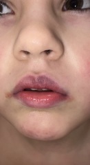 Purple lips in bath?