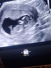 Gender guesses