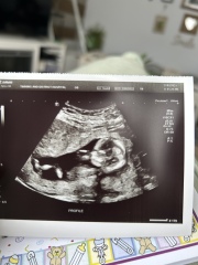 Nub and potty shot guesses (13 weeks 4 days)