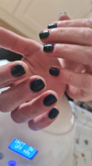 CBT therapy ? Did it help?