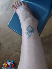 Swelling from varicose veins? (Photos)