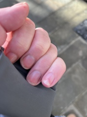 Fingernails, help!