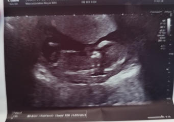 Due September 2023 after miscarriage 🌈