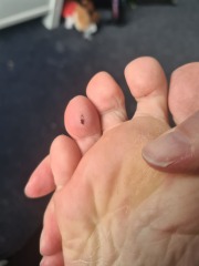 What is wrong with my toe? (photos attached)