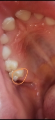 Do these look like cavities?