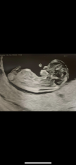 Can you guess my baby’s gender?