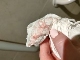 Implantation bleeding.