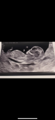 Can you guess my baby’s gender?