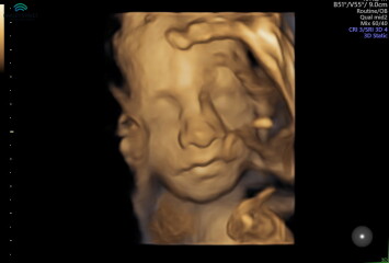 June 2023 Babies ☀️ (thread four)