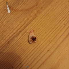 Anyone want to see my extracted tooth? *Trigger Warning* Photo attached