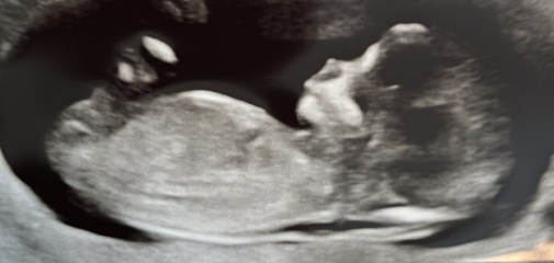 Boy or girl?