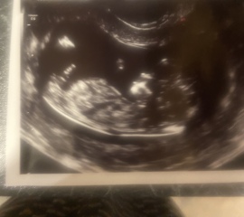 Is this a boy nub?