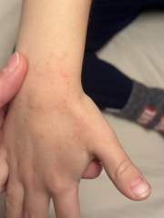 What is this rash?!