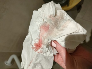 Implantation bleeding?