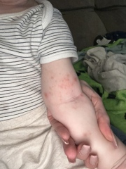 What are these spots?