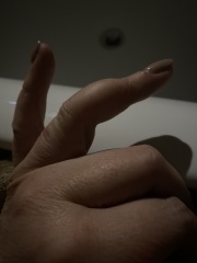  malignant osseous tumors of the fingers?