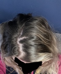 Hair help please 🙏 