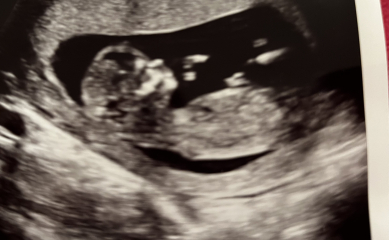 End Aug/Early Sept Due Date (Thread 2)