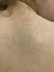 Rash on 2 year old