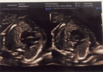 Due end of Aug/Sept babies 🤞🏻