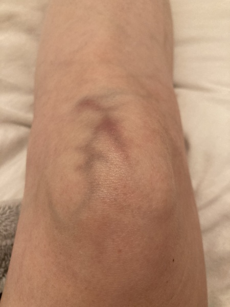 What's happened to my knee?!!