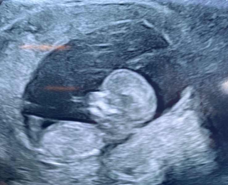 October - into the second trimester!