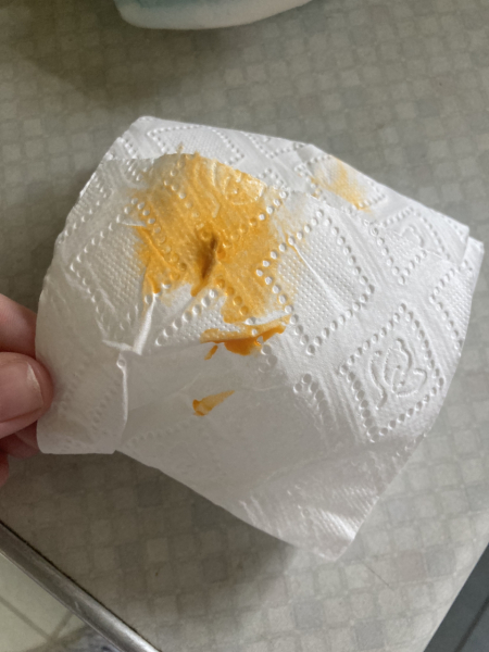 Celiac in children - how did you know?