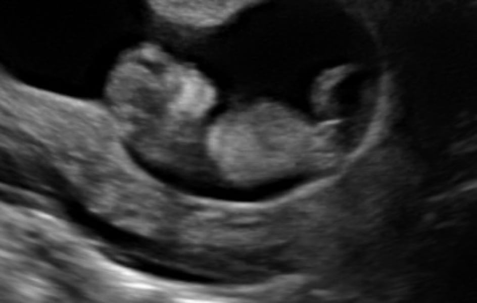 October - into the second trimester!