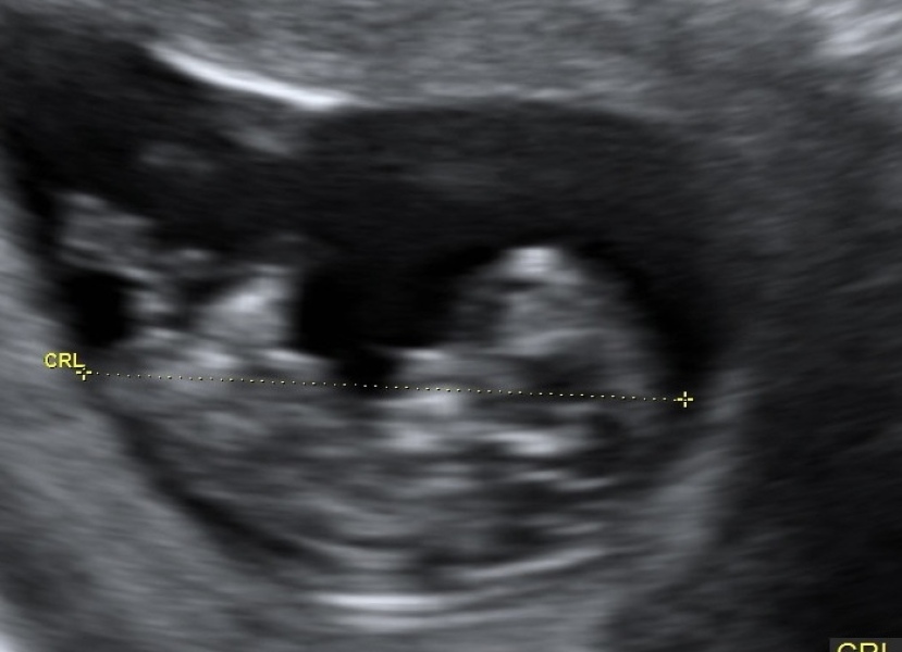 Due October 2023 - thread 4