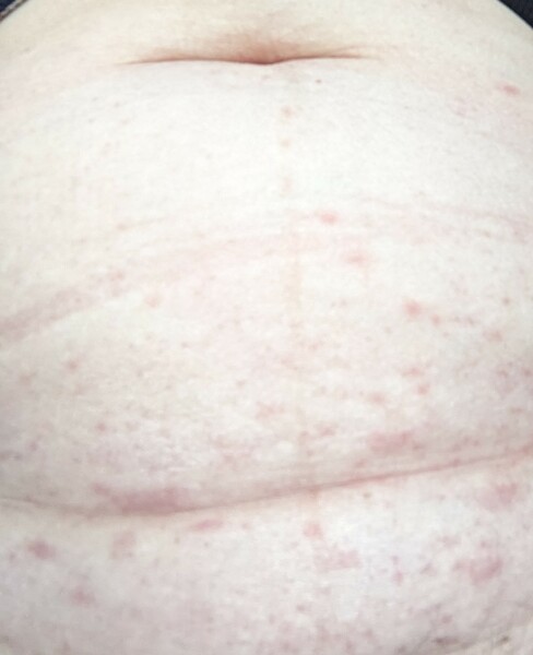 What could this rash be?