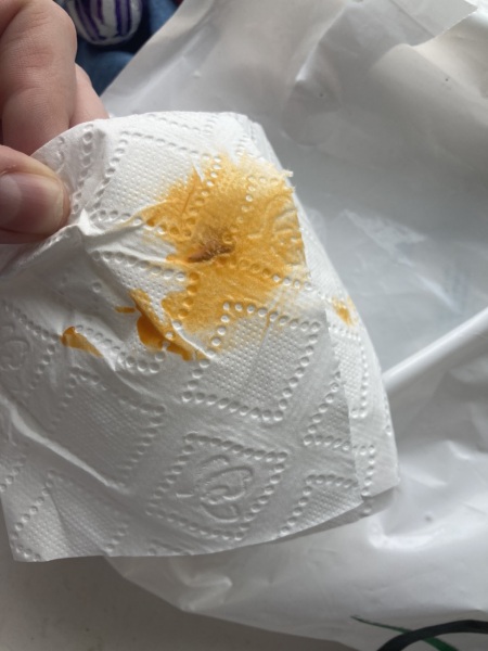 Oily orange poo - panicking (picture)