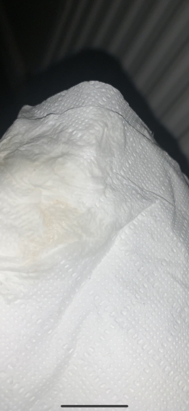 Implantation/is this pink?