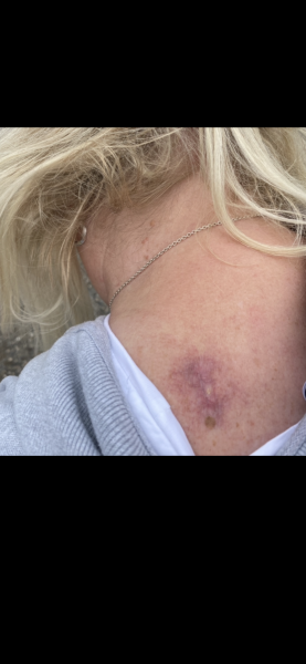 Anyone know what this is in my ear?