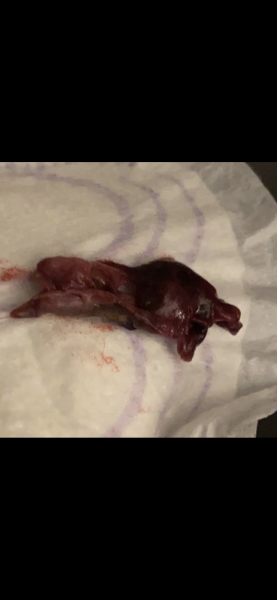Is this an early miscarriage? (WARNING Graphic pic) *Title edited by MNHQ*