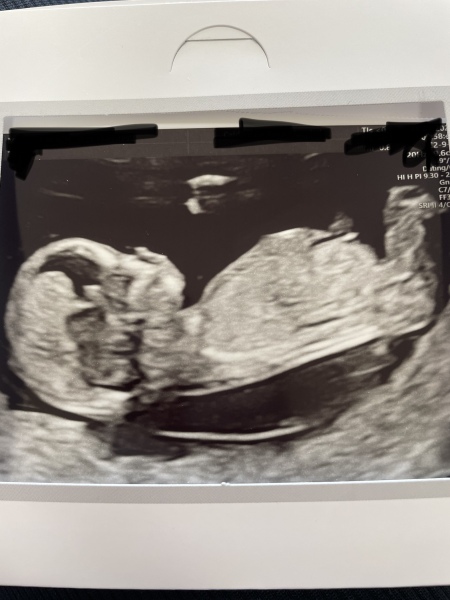 October - into the second trimester!