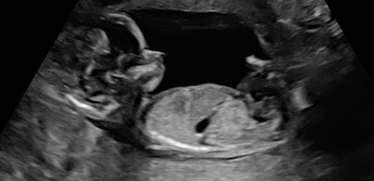 October - into the second trimester!