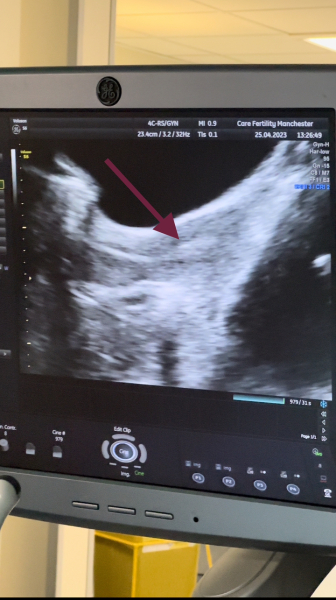 IVF April 2023 - looking for buddies!