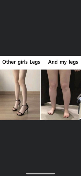 Is there any way to thin down legs (obtain Pins) through diet and exercise 