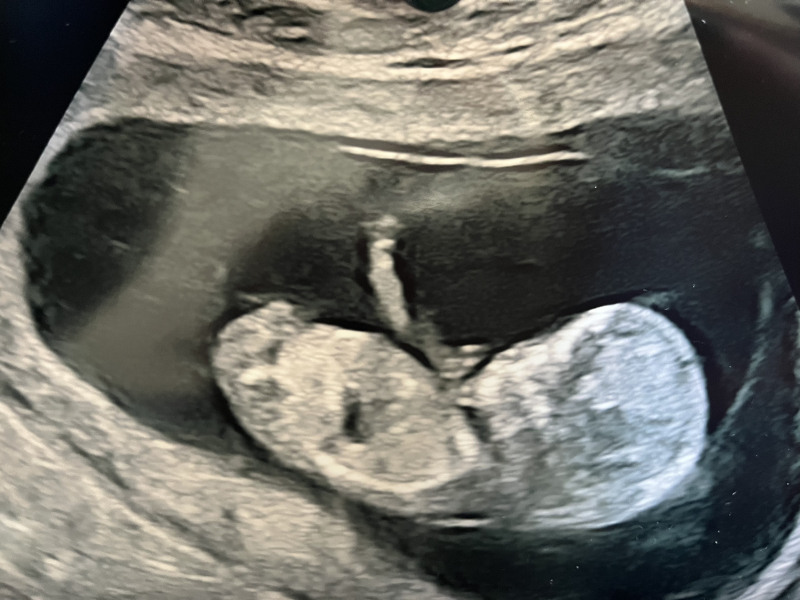 October - into the second trimester!