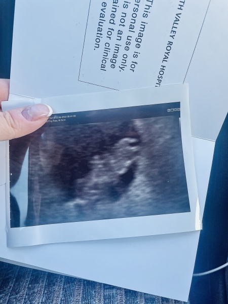 Pregnant after miscarriage 