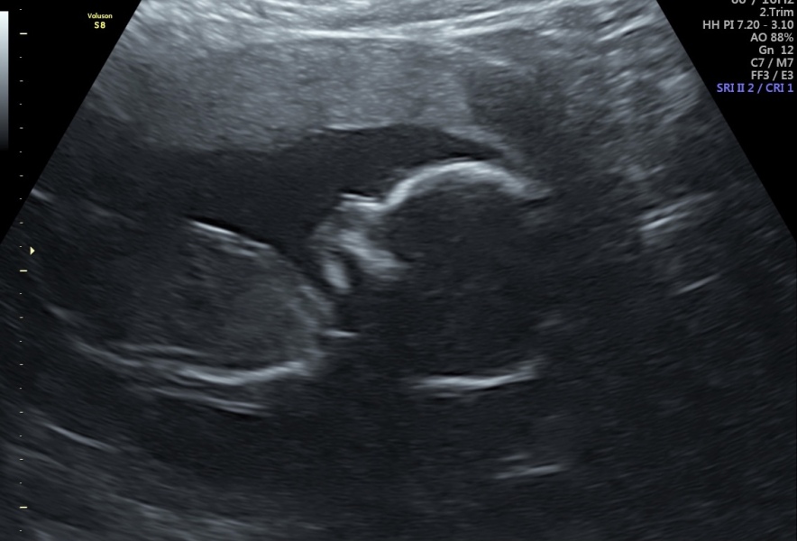Due October 2023 - thread 6