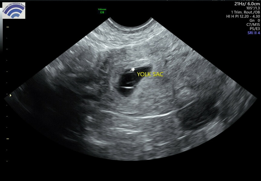 Early scan confusion