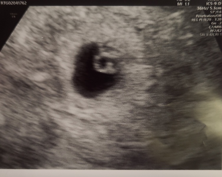 Due November 2023 - part 2