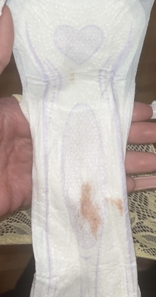 Implantation bleeding? TMI