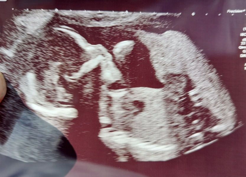 August Due Date Crew - Trimester 2 (Thread 7)
