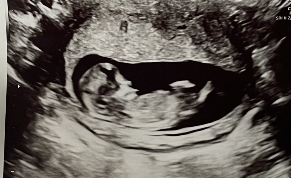 October - into the second trimester!