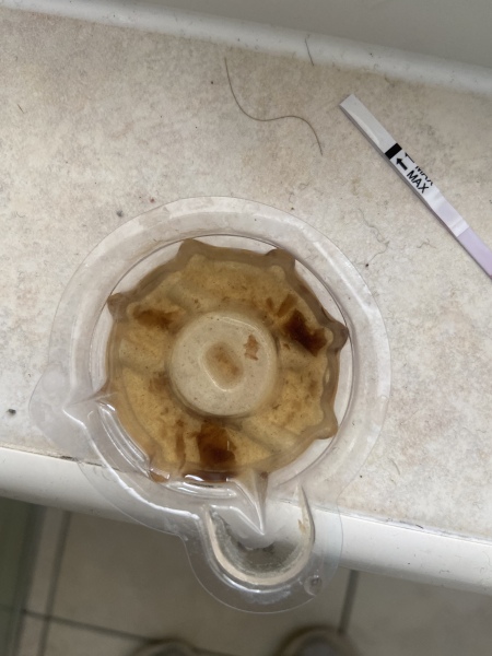 Brown discharge