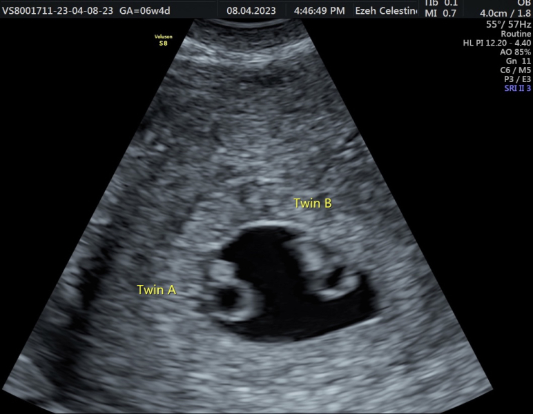 Due December 2023