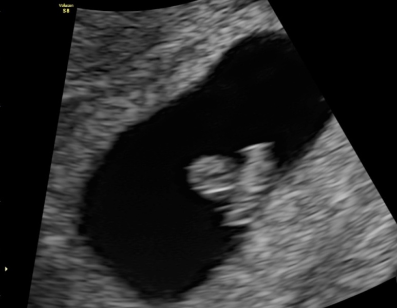 TWW - Testing Around 1st March 