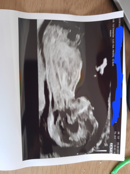 October - into the second trimester!